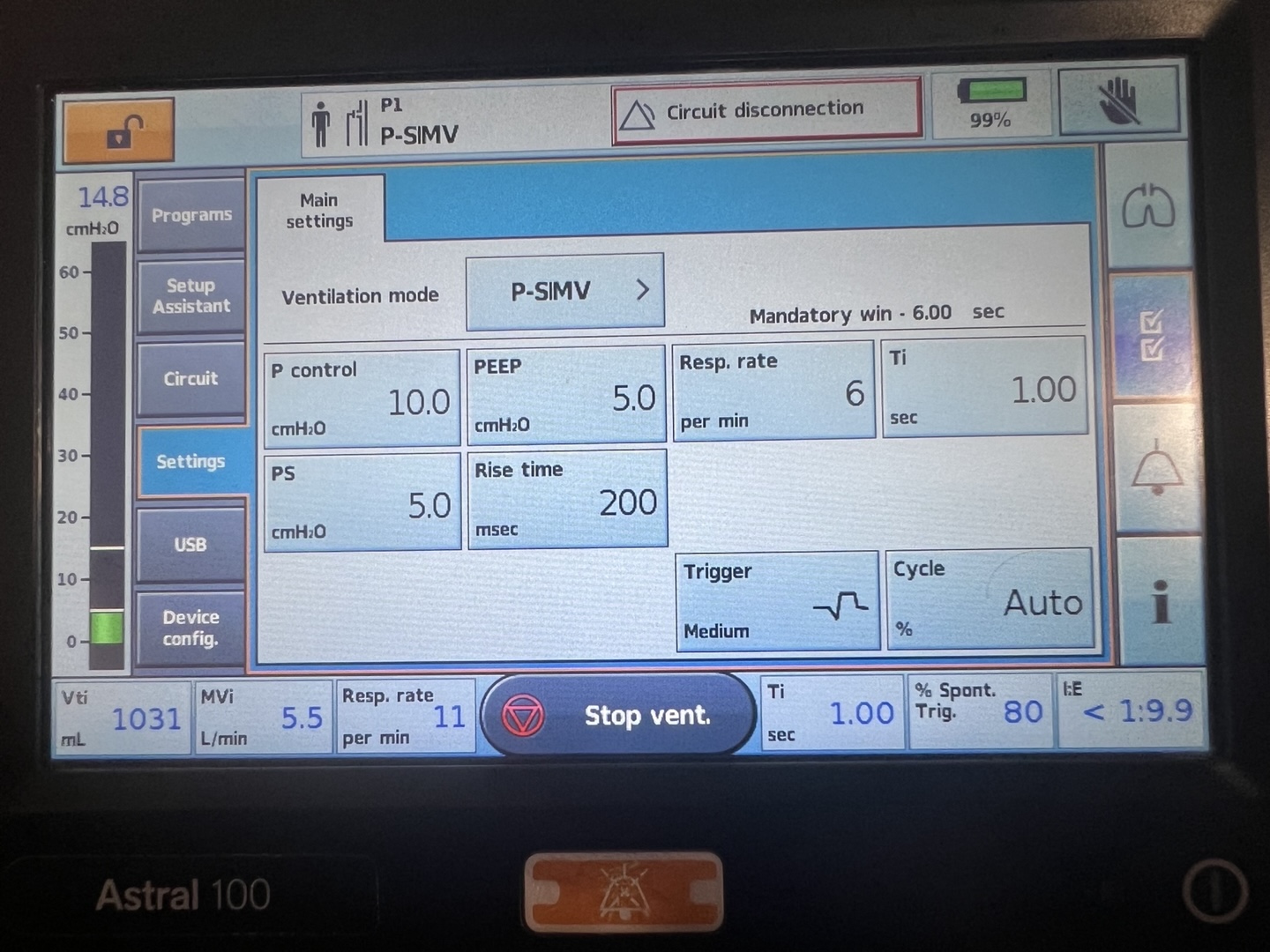 Screenshot of P-SIMV settings: P control 10, PEEP 5, RR 6 bpm, PS 5