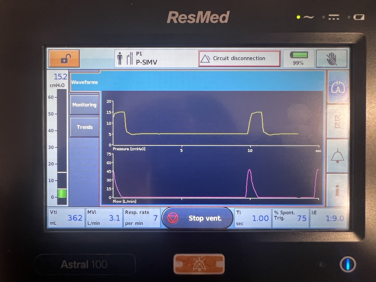 Pressure/flow waveforms showing two controlled breaths 10 s apart