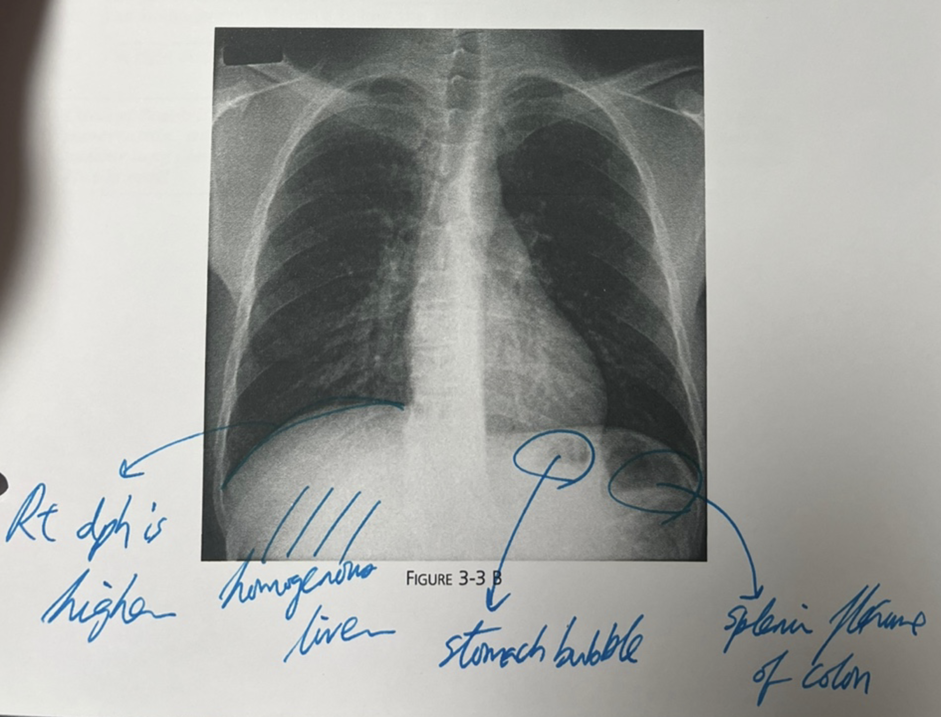 Additional chest X-ray radiograph with labels