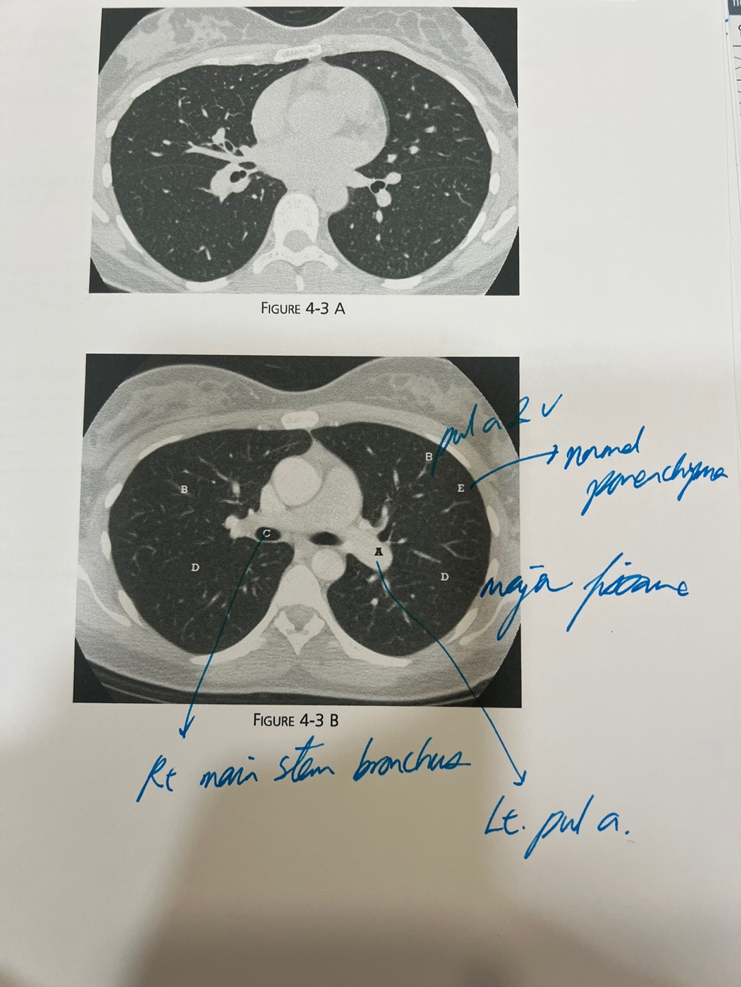 CT Image 3